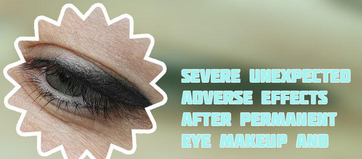 Permanent eye